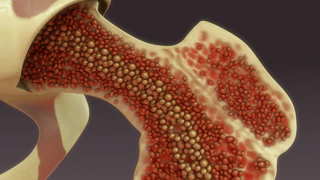 BMC for Cartilage